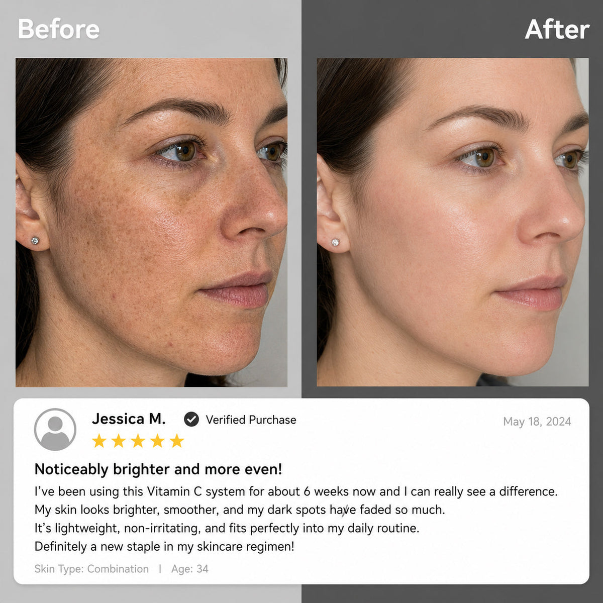 Dual Chamber Vitamin C Skincare Cream