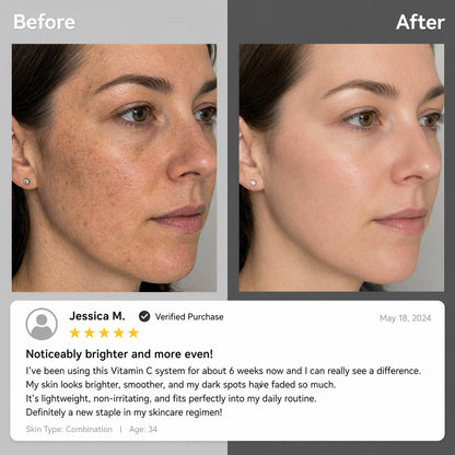 Dual Chamber Vitamin C Skincare Cream