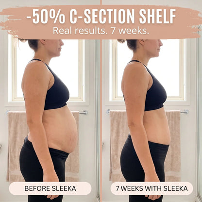 Postpartum Recovery Brief — 360° Compression