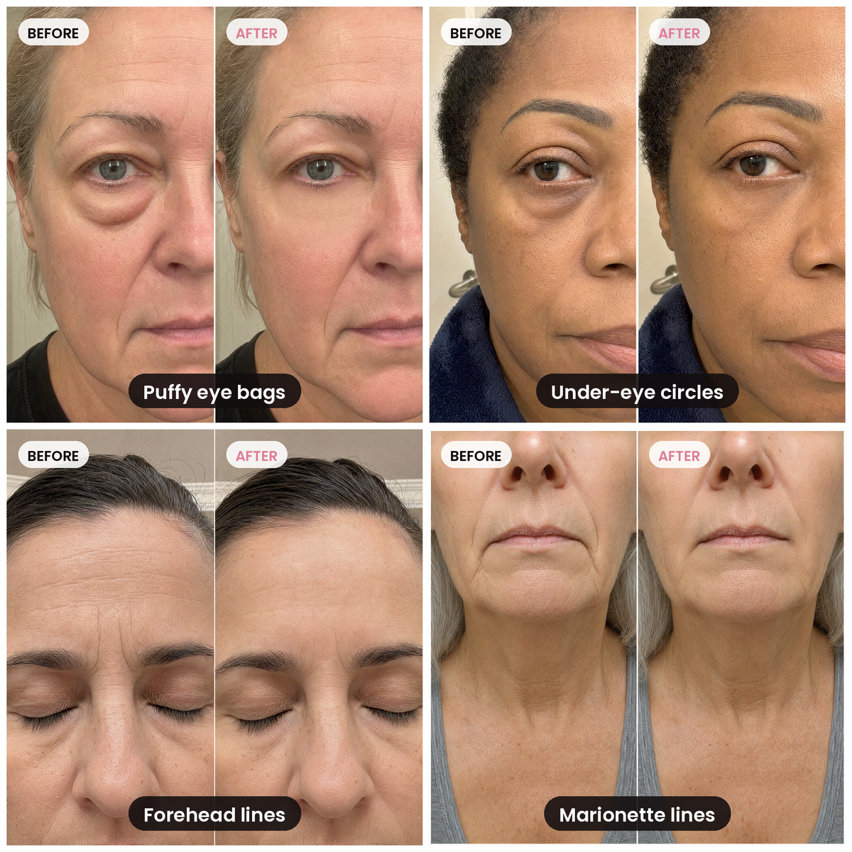 K-Lift™ Instant Lift Serum | PDRN + Peptides — image 2