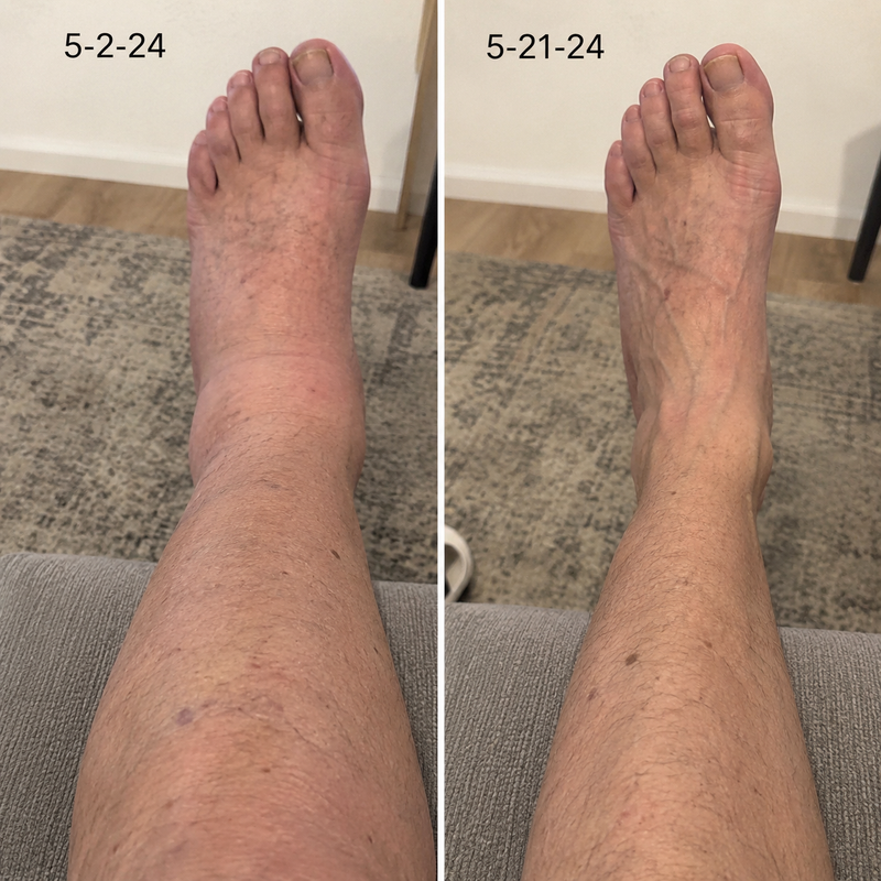 using CurveveraMax less than 8 weeks