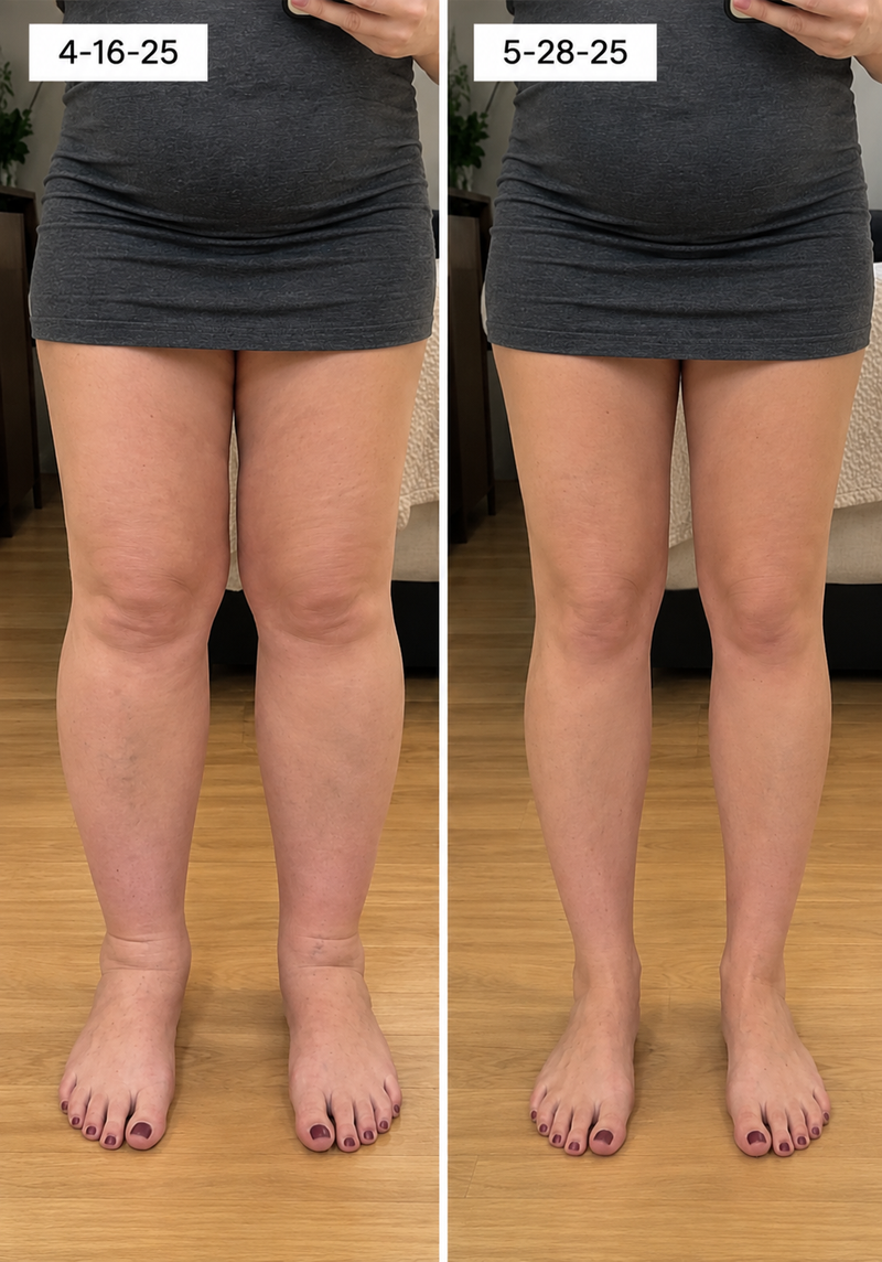 using CurveveraMax less than 8 weeks