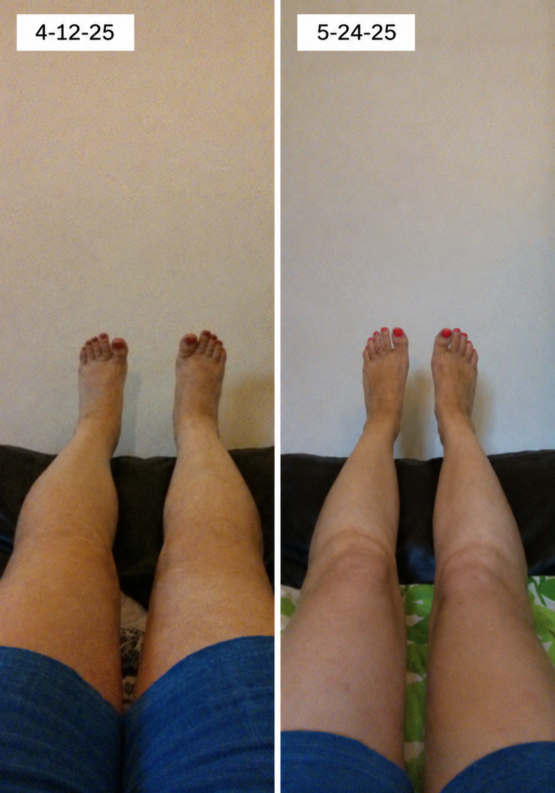 using CurveveraMax less than 8 weeks