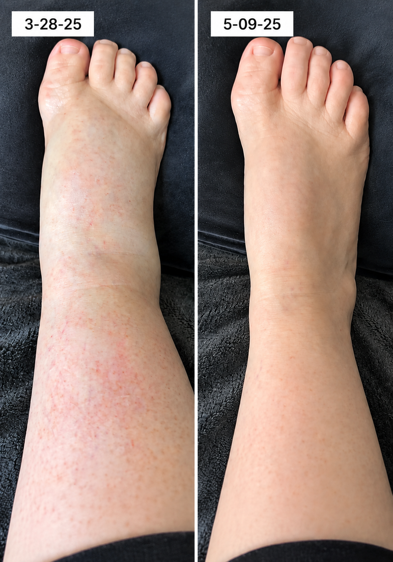 using CurveveraMax less than 8 weeks